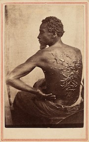 'Scourged Back' - Photograph depiciting the horrors of slavery